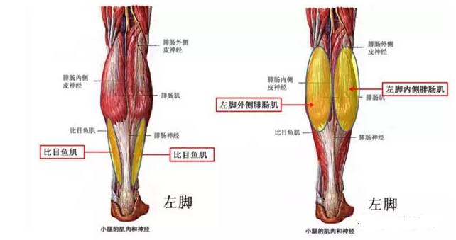 小腿疼痛可能是腓肠肌出问题了,针刀教你怎么办!